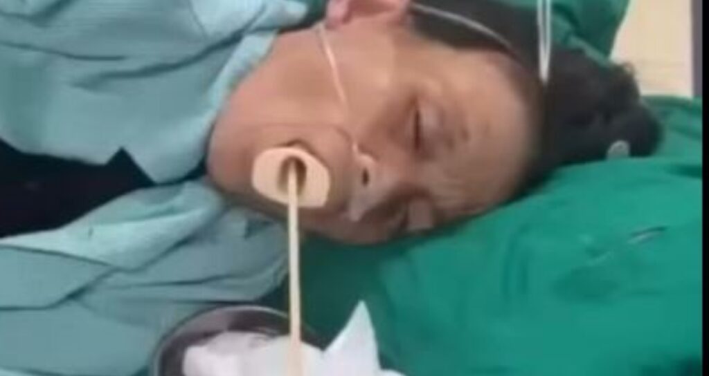 Ağzından devasa solucan çıkarıldı! Meğer eti hep yanlış pişirmiş