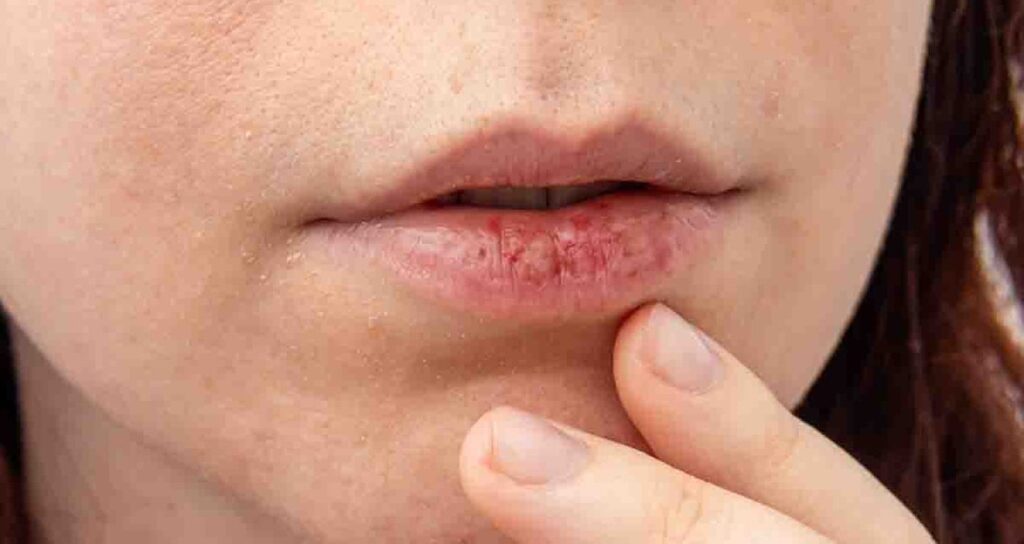 İşte dudak renginize göre sahip olduğunuz hastalıklar
