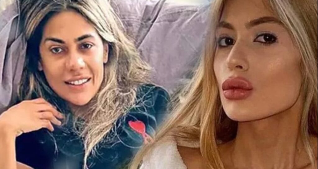 Nihal Candan’ın son hali gündem oldu