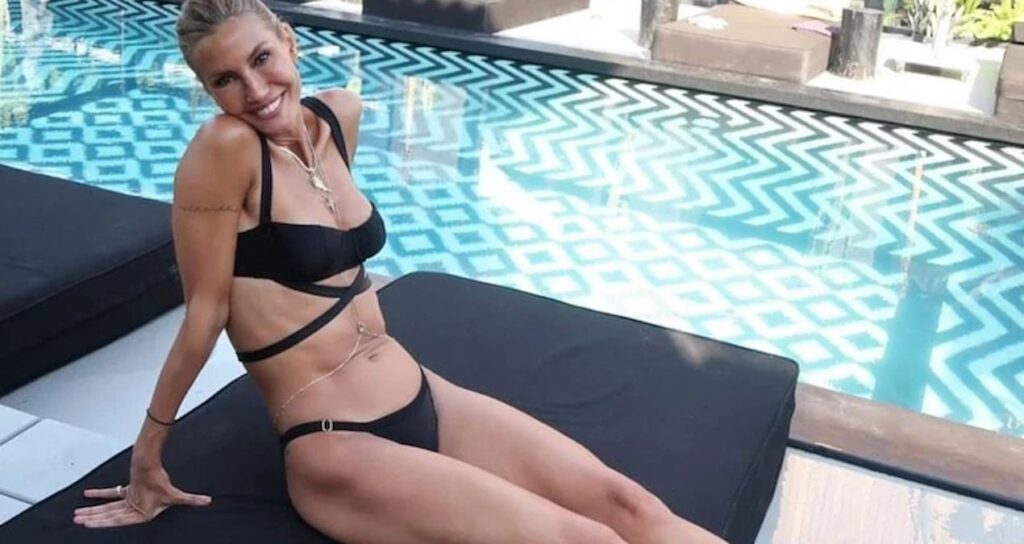 Çağla Şıkel’in bacakları mosmor oldu