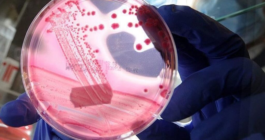 Erkeklerde en çok görülen ikinci kanser türü belli oldu