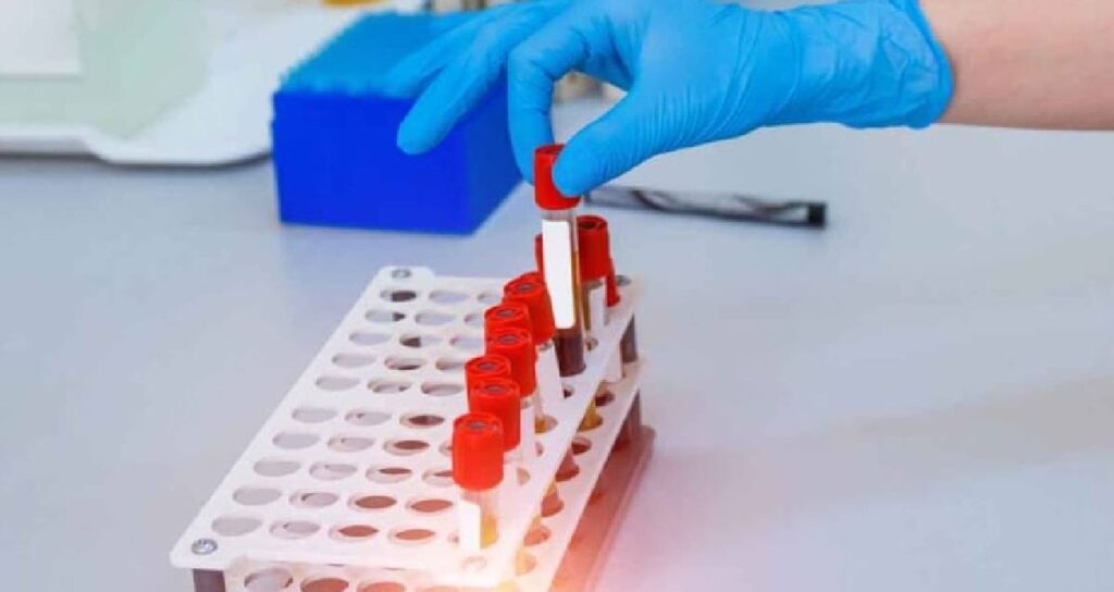 Gribe an az yakalanan kan grubu belli oldu