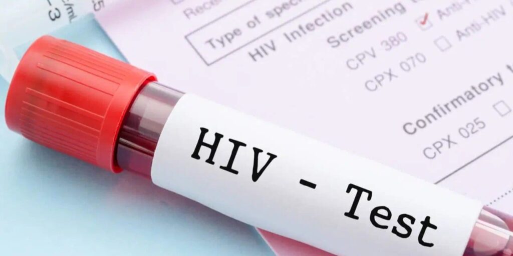 Türkiye’de HIV alarmı